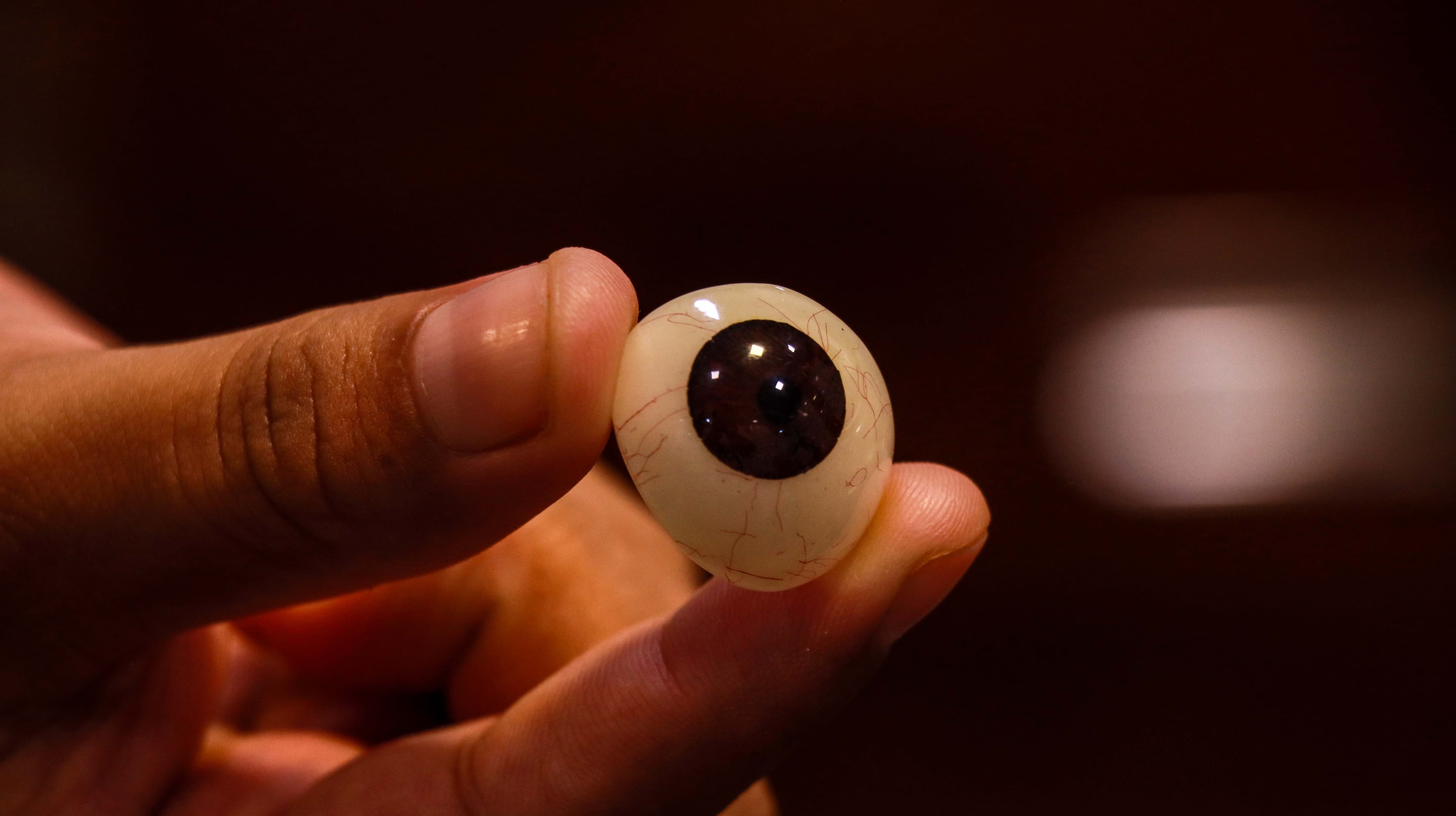 Orbit and Oculoplasty 1