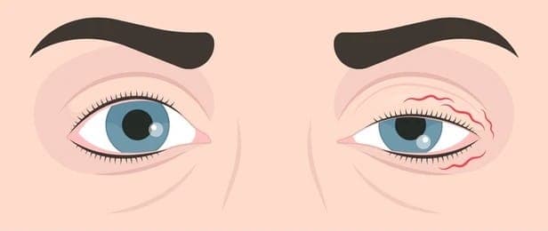 Orbit and Oculoplasty 3