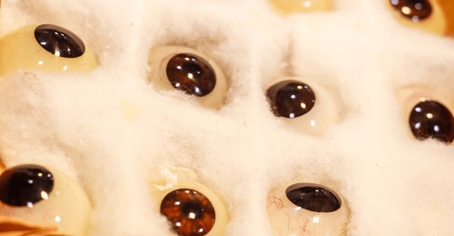 Prosthetic Eye