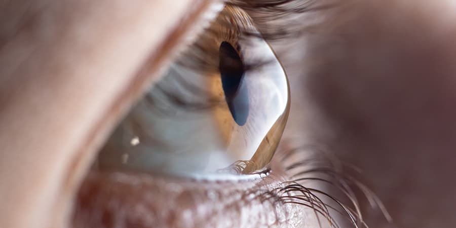 Cornea 1