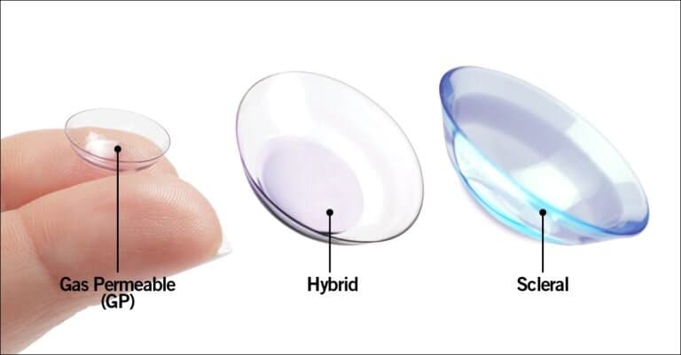 Cornea 3